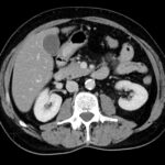 Computertomographie (CT)