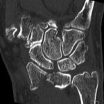 Computertomographie (CT)