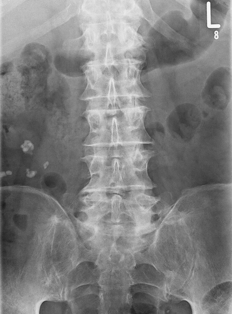 Röntgen und Durchleuchtung 🩻 Radiologie Saalekreis